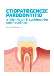 Etiopatogeneze parodontitid a jejich vztah k systémovým onemocněním