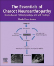 The Essentials of Charcot Neuroarthropathy : Biomechanics, Pathophysiology, and MRI Findings