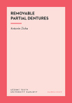 Removable Partial Dentures